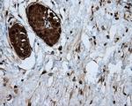 ATP Citrate Lyase Antibody in Immunohistochemistry (Paraffin) (IHC (P))