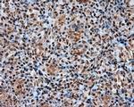 ATP Citrate Lyase Antibody in Immunohistochemistry (Paraffin) (IHC (P))