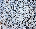 ATP Citrate Lyase Antibody in Immunohistochemistry (Paraffin) (IHC (P))