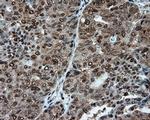 ATP Citrate Lyase Antibody in Immunohistochemistry (Paraffin) (IHC (P))