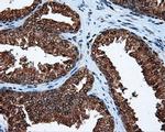 ATP Citrate Lyase Antibody in Immunohistochemistry (Paraffin) (IHC (P))