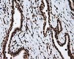 ATP Citrate Lyase Antibody in Immunohistochemistry (Paraffin) (IHC (P))