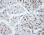 ATP Citrate Lyase Antibody in Immunohistochemistry (Paraffin) (IHC (P))