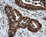 ATP Citrate Lyase Antibody in Immunohistochemistry (Paraffin) (IHC (P))