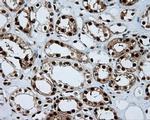 ATP Citrate Lyase Antibody in Immunohistochemistry (Paraffin) (IHC (P))