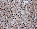 ATP Citrate Lyase Antibody in Immunohistochemistry (Paraffin) (IHC (P))