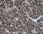 ATP Citrate Lyase Antibody in Immunohistochemistry (Paraffin) (IHC (P))