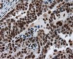 ATP Citrate Lyase Antibody in Immunohistochemistry (Paraffin) (IHC (P))