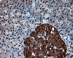 ATP Citrate Lyase Antibody in Immunohistochemistry (Paraffin) (IHC (P))