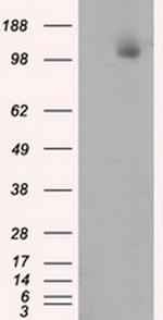 ATP Citrate Lyase Antibody in Western Blot (WB)