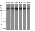 ATP Citrate Lyase Antibody in Western Blot (WB)