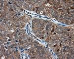 NIT1 Antibody in Immunohistochemistry (Paraffin) (IHC (P))