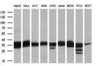 RDH11 Antibody in Western Blot (WB)