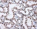 SHC Antibody in Immunohistochemistry (Paraffin) (IHC (P))