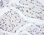 SHC Antibody in Immunohistochemistry (Paraffin) (IHC (P))