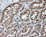 NIT1 Antibody in Immunohistochemistry (Paraffin) (IHC (P))