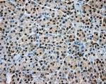 NIT1 Antibody in Immunohistochemistry (Paraffin) (IHC (P))