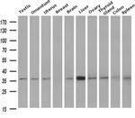 NIT1 Antibody in Western Blot (WB)