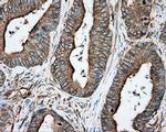 TUBA8 Antibody in Immunohistochemistry (Paraffin) (IHC (P))