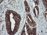 TUBA8 Antibody in Immunohistochemistry (Paraffin) (IHC (P))