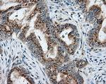 NIT2 Antibody in Immunohistochemistry (Paraffin) (IHC (P))