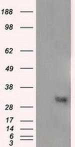 NIT2 Antibody in Western Blot (WB)