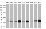 NIT2 Antibody in Western Blot (WB)