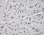 DAPK2 Antibody in Immunohistochemistry (Paraffin) (IHC (P))