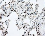 DAPK2 Antibody in Immunohistochemistry (Paraffin) (IHC (P))