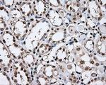 DAPK2 Antibody in Immunohistochemistry (Paraffin) (IHC (P))