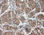 NIT2 Antibody in Immunohistochemistry (Paraffin) (IHC (P))