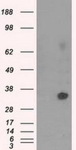 NIT2 Antibody in Western Blot (WB)