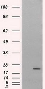 NIT2 Antibody in Western Blot (WB)