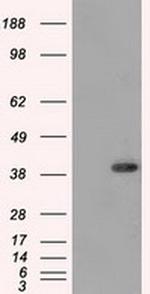 DNTTIP1 Antibody in Western Blot (WB)