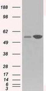 GPI Antibody in Western Blot (WB)