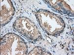 ALDH3A1 Antibody in Immunohistochemistry (Paraffin) (IHC (P))