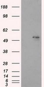 ALDH3A1 Antibody in Western Blot (WB)