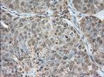 GPI Antibody in Immunohistochemistry (Paraffin) (IHC (P))