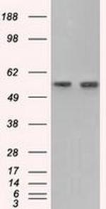 GPI Antibody in Western Blot (WB)