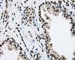 BMAL1 Antibody in Immunohistochemistry (Paraffin) (IHC (P))