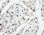 BMAL1 Antibody in Immunohistochemistry (Paraffin) (IHC (P))