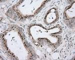 ACSBG1 Antibody in Immunohistochemistry (Paraffin) (IHC (P))