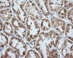 ACSBG1 Antibody in Immunohistochemistry (Paraffin) (IHC (P))