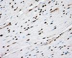 ACSBG1 Antibody in Immunohistochemistry (Paraffin) (IHC (P))