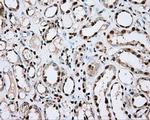 ACSBG1 Antibody in Immunohistochemistry (Paraffin) (IHC (P))