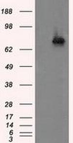 ACSBG1 Antibody in Western Blot (WB)