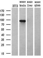 ACSBG1 Antibody in Western Blot (WB)