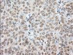 PDE4A Antibody in Immunohistochemistry (Paraffin) (IHC (P))