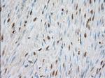 PDE4A Antibody in Immunohistochemistry (Paraffin) (IHC (P))