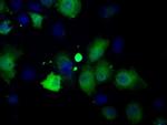 Profilin 1 Antibody in Immunocytochemistry (ICC/IF)